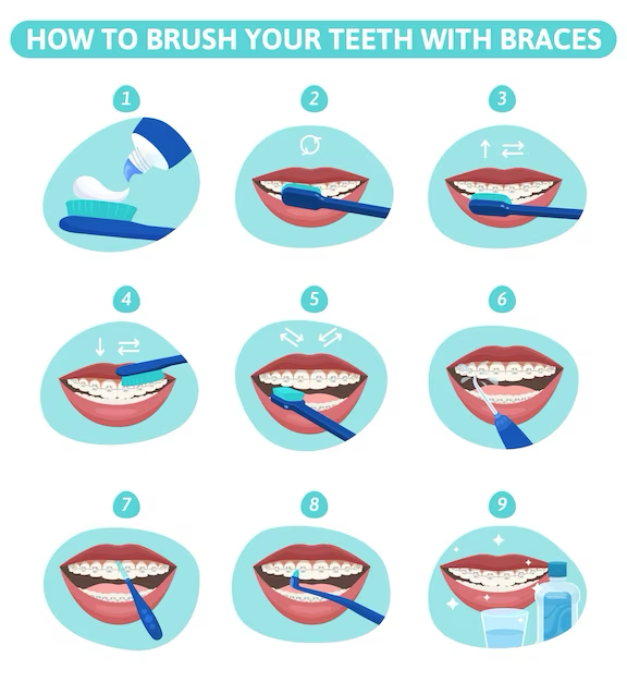 How to brush with braces